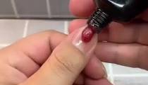 کاشت پلی ژل با یووی انگشتی