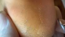 پدیکور حرفه‌ای با دیسک پدیکور