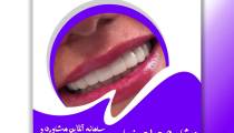 نمونه کار جراحی دندان در مشهد