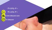 جراحی زیبایی بینی در مشهد