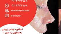 قیمت جراحی زیبایی بینی در بندر عباس