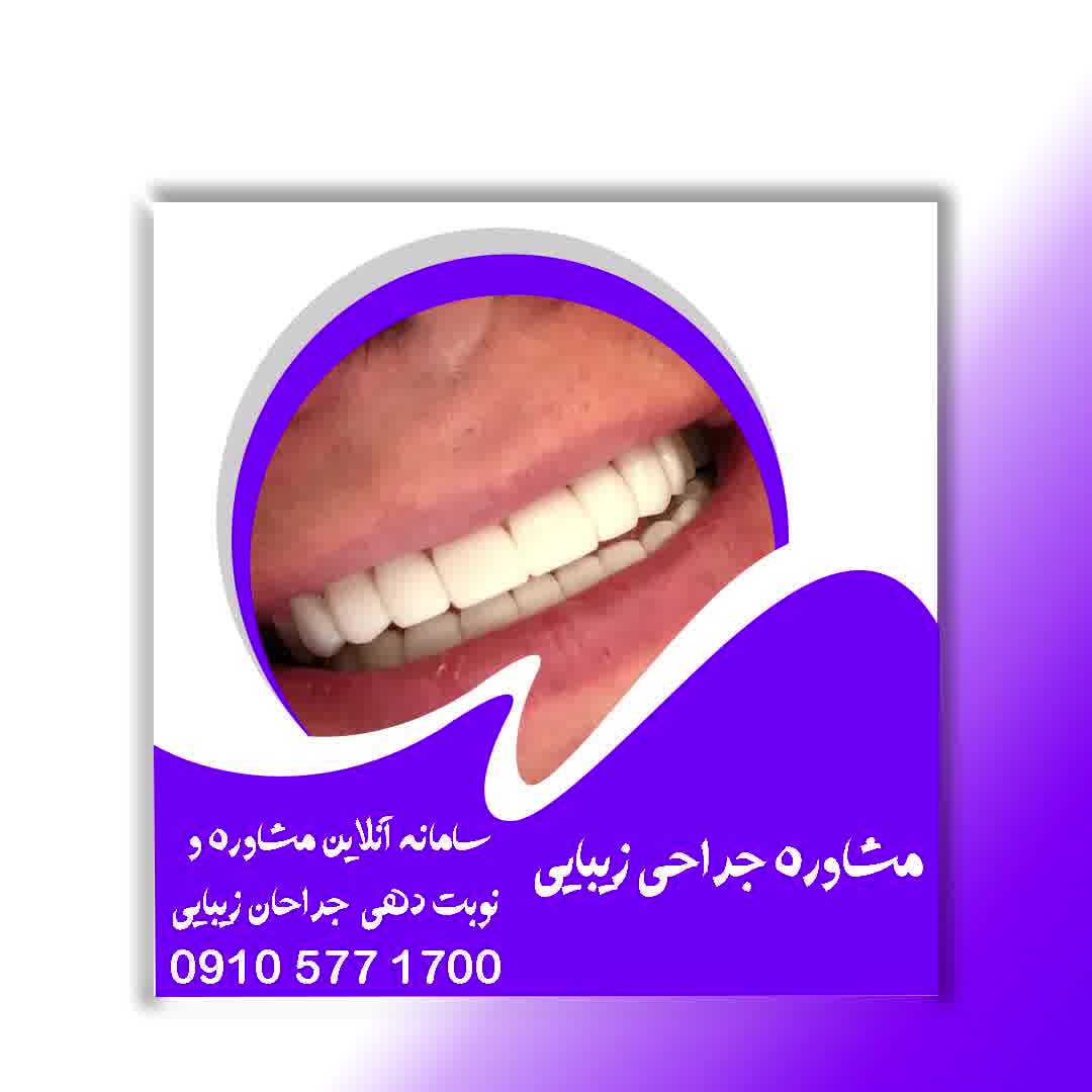 عصب کشی دندان