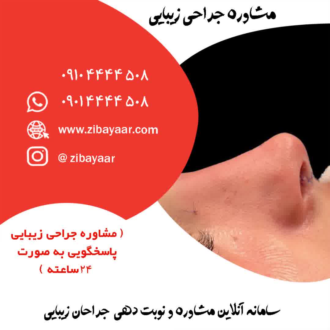 عمل بینی در بندر عباس