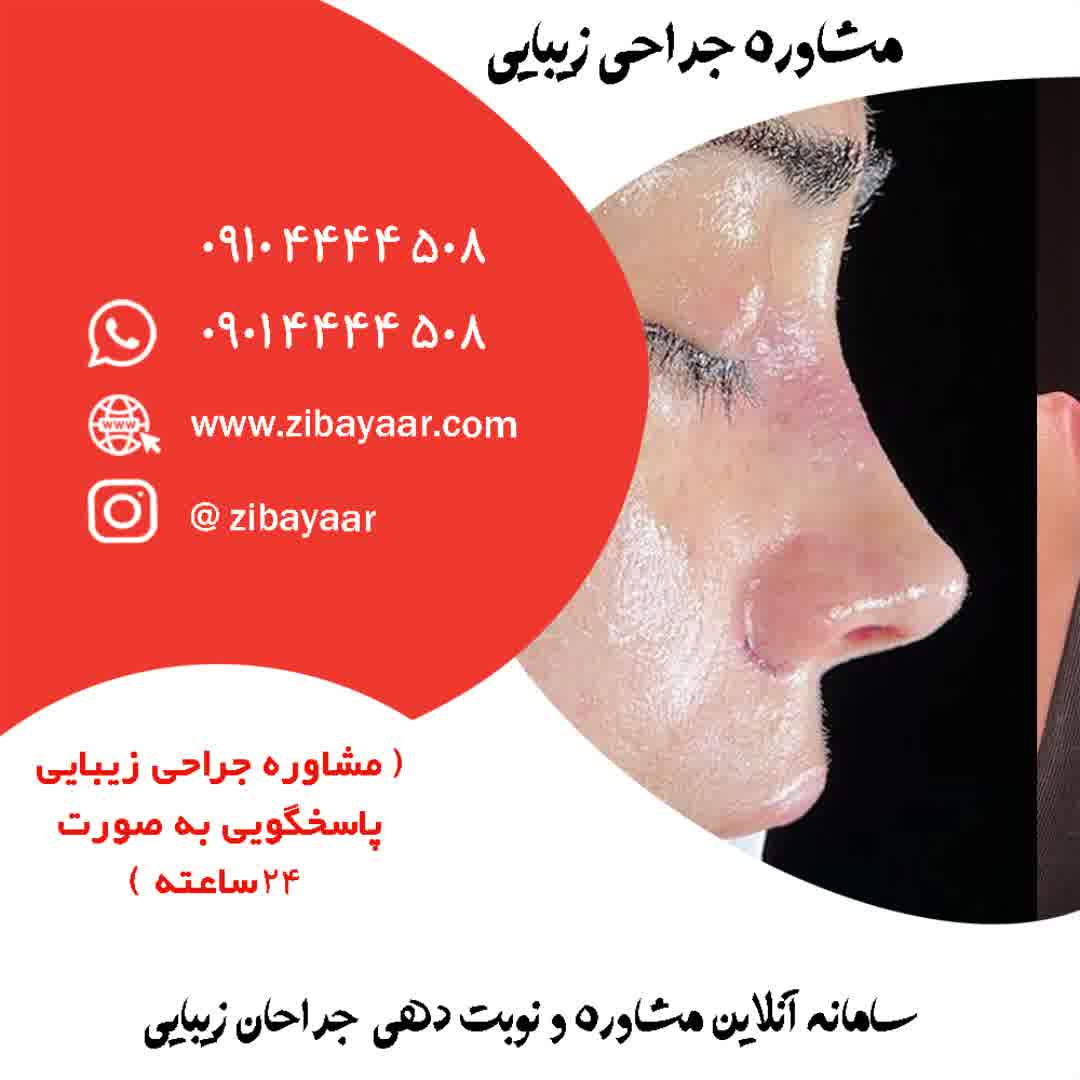 قیمت جراحی زیبایی بینی در بندر عباس