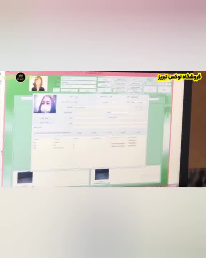 آموزش استفاده از دستگاه عنبیه شناسی