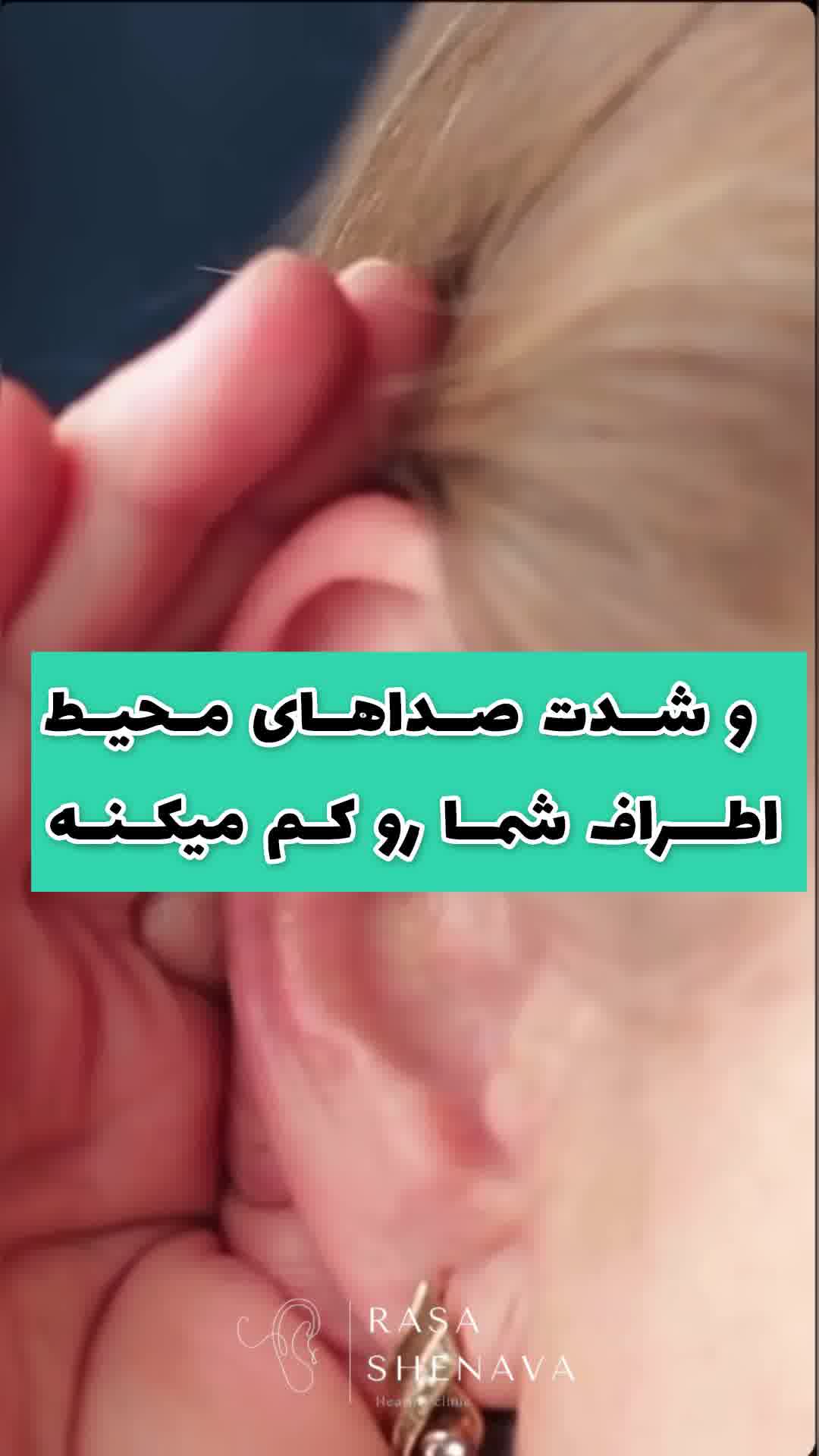 آیا جرم گوش باعث ایجاد وزوز می شود؟