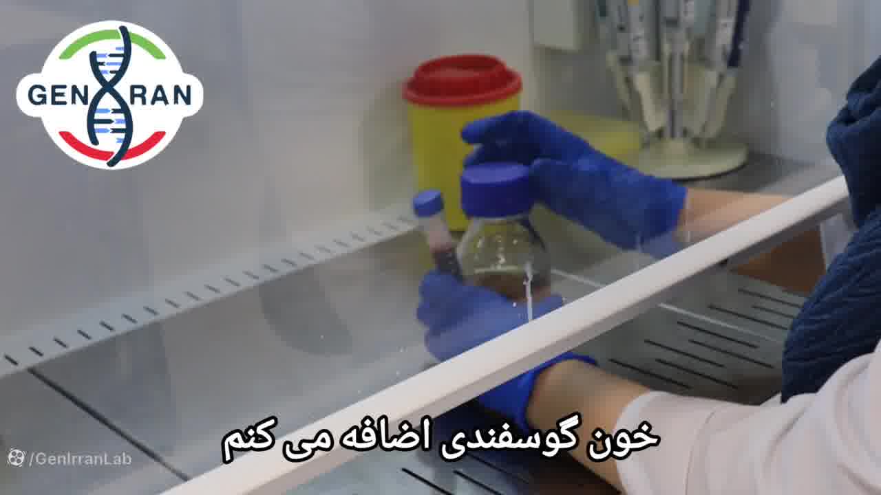 طرز تهیه محیط کشت چاکلت آگار